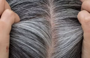 सफेद बाल बिगाड़ रहे हैं खूबसूरती तो ना हों परेशान, आज़माकर देखें ये आयुर्वेदिक नुस्खे