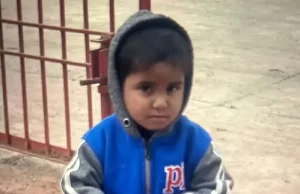 Ludhiana में 3 साल की मासूम पर कुत्ते ने किया हमला: सिर और चेहरा बुरी तरह जख्मी, 35 टांके लगे; घर के बाहर खेल रही थी बच्ची