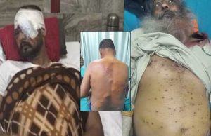 ਜ਼ਖਮੀ ਕਿਸਾਨਾਂ ਦੇ ਸਰੀਰ ਖੋਲ੍ਹ ਰਹੇ ਨੇ ਹਰਿਆਣਾ ਦੀ ਪੋਲ!