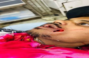 ਦਿੱਲੀ-ਪਠਾਨਕੋਟ ਐਕਸਪ੍ਰੈੱਸ ‘ਤੇ ਪਥਰਾਅ; ਇਕ ਯਾਤਰੀ ਜ਼ਖ਼ਮੀ, ਫਤਿਹਗੜ੍ਹ ਰੇਲਵੇ ਸਟੇਸ਼ਨ ’ਤੇ ਜ਼ਖ਼ਮੀ ਨੂੰ ਕਰਵਾਇਆ ਹਸਪਤਾਲ ਦਾਖ਼ਲ