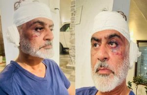 ਪੰਜਾਬੀ ਅਦਾਕਾਰ ‘ਤੇ ਜਾਨਲੇਵਾ ਹਮਲਾ, ਤੇਜ਼ਧਾਰ ਹਖਿਆਰਾਂ ਨਾਲ ਵੱਢਿਆ ਕੰਨ, ਦੇਖੋ ਤਸਵੀਰਾਂ