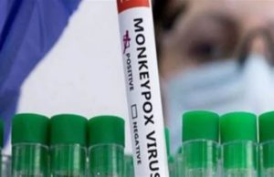 Mpox Virus: ਭਾਰਤ ਪਹੁੰਚਿਆ Mpox, ਪਹਿਲੇ ਕੇਸ ਦੀ ਪੁਸ਼ਟੀ; ਦੇਸ਼ ਲਈ ਕਿੰਨਾ ਖ਼ਤਰਾ ਹੈ? ਕੇਂਦਰ ਨੇ ਸਪੱਸ਼ਟ ਕੀਤਾ ਹੈ