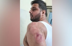 Jalandhar: ਪਾਰਕਿੰਗ ਨੂੰ ਲੈ ਕੇ ਕਾਂਗਰਸ ਦੇ ਕੌਂਸਲਰ ‘ਤੇ ਆਪ ਆਗੂ ਵਿਚਕਾਰ ਝਗੜਾ, ਲੱਤਾਂ-ਮੁੱਕਿਆਂ ਨਾਲ ਕੀਤਾ ਹਮਲਾ