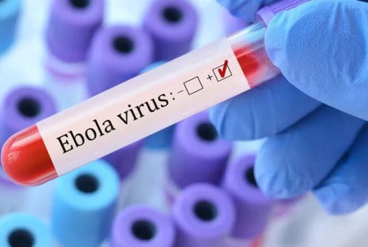 Ebola Case in Congo: कांगो में इबोला का प्रकोप जारी, मामले बढ़कर हुए 1,048