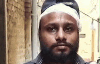Jalandhar में सोते परिवार पर गिरी छत:पिता-पुत्र समेत 3 लोग घायल, 8 साल के बच्चे की हालत गंभीर