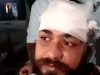 Jalandhar में विवाद के बाद रेहड़ी संचालक पर हमला:आमलेट बनाने में देरी पर हुआ विवाद; सिर और बाजू पर गंभीर चोटें आई