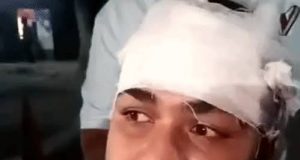 Jalandhar में विवाद के बाद रेहड़ी संचालक पर हमला:आमलेट बनाने में देरी पर हुआ विवाद; सिर और बाजू पर गंभीर चोटें आई