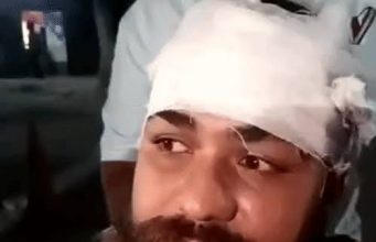 Jalandhar में विवाद के बाद रेहड़ी संचालक पर हमला:आमलेट बनाने में देरी पर हुआ विवाद; सिर और बाजू पर गंभीर चोटें आई